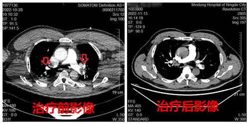 治療前后對比圖_副本.jpg