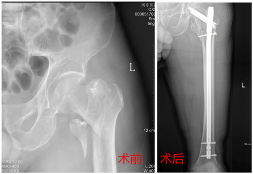術(shù)前術(shù)后對(duì)比圖_副本.jpg